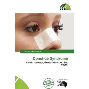   Donohue Syndrome (9786200836939) Columba Sara Evelyn Books
