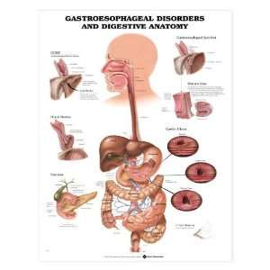 Gastroesophageal Disorders and Digestive Anatomy Chart:  