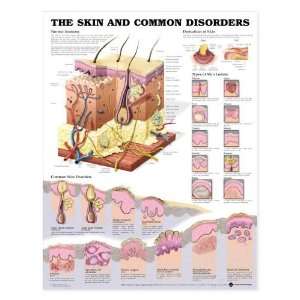  Skin Anatomy and Common Disorders Chart Industrial & Scientific